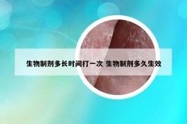 生物制剂多长时间打一次 生物制剂多久生效