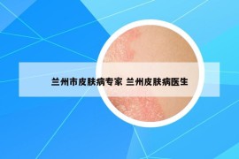 兰州市皮肤病专家 兰州皮肤病医生