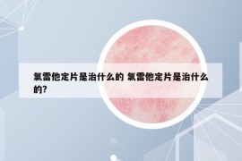 氯雷他定片是治什么的 氯雷他定片是治什么的?