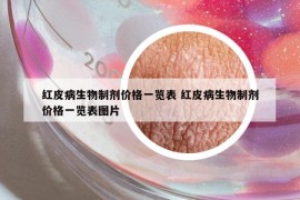 红皮病生物制剂价格一览表 红皮病生物制剂价格一览表图片