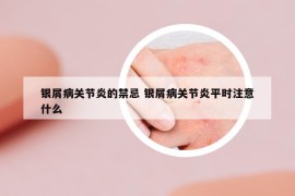 银屑病关节炎的禁忌 银屑病关节炎平时注意什么