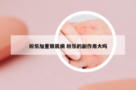 纷乐加重银屑病 纷乐的副作用大吗