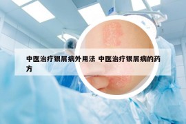 中医治疗银屑病外用法 中医治疗银屑病的药方