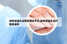 加味逍遥丸治银屑病关节炎 加味逍遥丸治疗银屑病甲