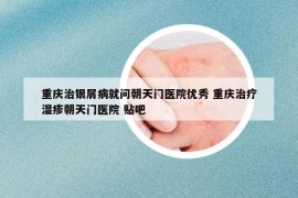 重庆治银屑病就问朝天门医院优秀 重庆治疗湿疹朝天门医院 贴吧