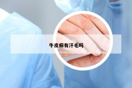 牛皮癣有汗毛吗