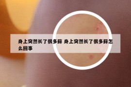 身上突然长了很多藓 身上突然长了很多藓怎么回事