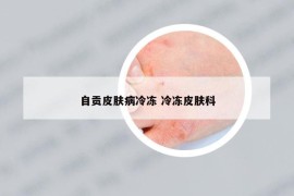 自贡皮肤病冷冻 冷冻皮肤科