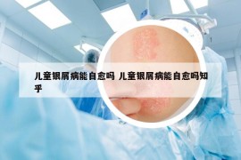 儿童银屑病能自愈吗 儿童银屑病能自愈吗知乎