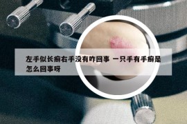 左手似长癣右手没有咋回事 一只手有手癣是怎么回事呀