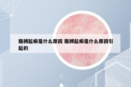 胳膊起癣是什么原因 胳膊起癣是什么原因引起的