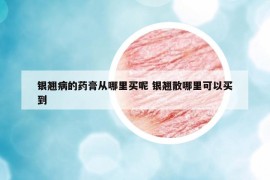 银翘病的药膏从哪里买呢 银翘散哪里可以买到