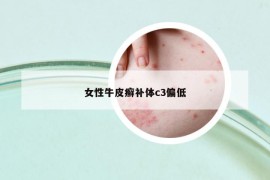 女性牛皮癣补体c3偏低