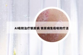 AI吸附治疗银屑病 银屑病免疫吸附疗法