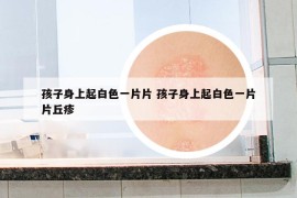 孩子身上起白色一片片 孩子身上起白色一片片丘疹