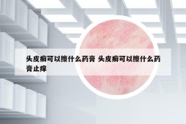 头皮癣可以擦什么药膏 头皮癣可以擦什么药膏止痒