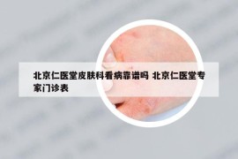 北京仁医堂皮肤科看病靠谱吗 北京仁医堂专家门诊表