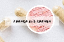 皮肤瘙痒起癣,怎么治 皮肤瘙痒起藓