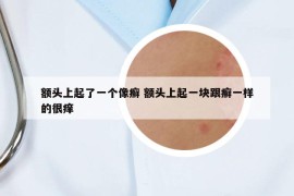 额头上起了一个像癣 额头上起一块跟癣一样的很痒