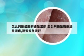 怎么判断是股癣还是湿疹 怎么判断是股癣还是湿疹,夏天长冬天好