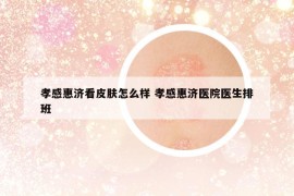 孝感惠济看皮肤怎么样 孝感惠济医院医生排班