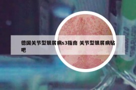 德国关节型银屑病s3指南 关节型银屑病贴吧