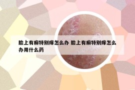 脸上有癣特别痒怎么办 脸上有癣特别痒怎么办用什么药