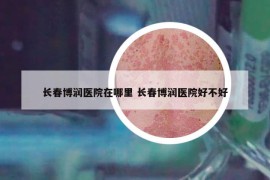 长春博润医院在哪里 长春博润医院好不好