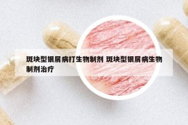 斑块型银屑病打生物制剂 斑块型银屑病生物制剂治疗