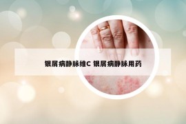 银屑病静脉维C 银屑病静脉用药