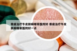 娄底治疗牛皮肤癣哪家医院好 娄底治疗牛皮肤癣哪家医院好一点