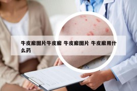 牛皮廨图片牛皮廨 牛皮廨图片 牛皮廨用什么药