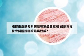 成都市皮肤专科医院哪家最具权威 成都市皮肤专科医院哪家最具权威?