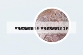 掌跖脓疱病怕什么 掌跖脓疱病的忌口表