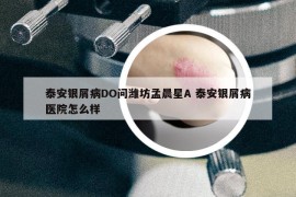 泰安银屑病DO问潍坊孟晨星A 泰安银屑病医院怎么样