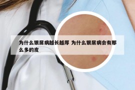 为什么银屑病越长越厚 为什么银屑病会有那么多的皮