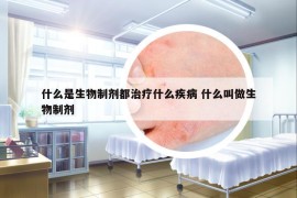 什么是生物制剂都治疗什么疾病 什么叫做生物制剂