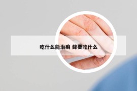 吃什么能治癣 藓要吃什么