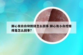 脚心有白白块刺挠怎么回事 脚心有小白疙瘩痒是怎么回事?