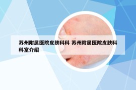 苏州附属医院皮肤科科 苏州附属医院皮肤科科室介绍