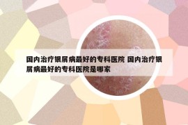 国内治疗银屑病最好的专科医院 国内治疗银屑病最好的专科医院是哪家