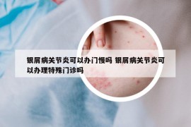 银屑病关节炎可以办门慢吗 银屑病关节炎可以办理特殊门诊吗