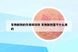 生物制剂的作用和功效 生物制剂是干什么用的