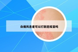 白癜风患者可以打新冠疫苗吗