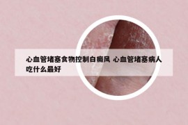 心血管堵塞食物控制白癜风 心血管堵塞病人吃什么最好