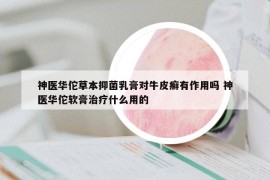 神医华佗草本抑菌乳膏对牛皮癣有作用吗 神医华佗软膏治疗什么用的