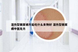 湿热型银屑病不能吃什么食物好 湿热型银屑病中医处方