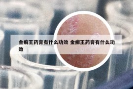 金癣王药膏有什么功效 金癣王药膏有什么功效