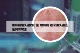 银屑病输头孢的计量 银屑病 适合用头孢还是阿奇霉素