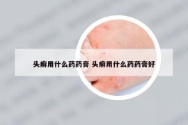 头癣用什么药药膏 头癣用什么药药膏好